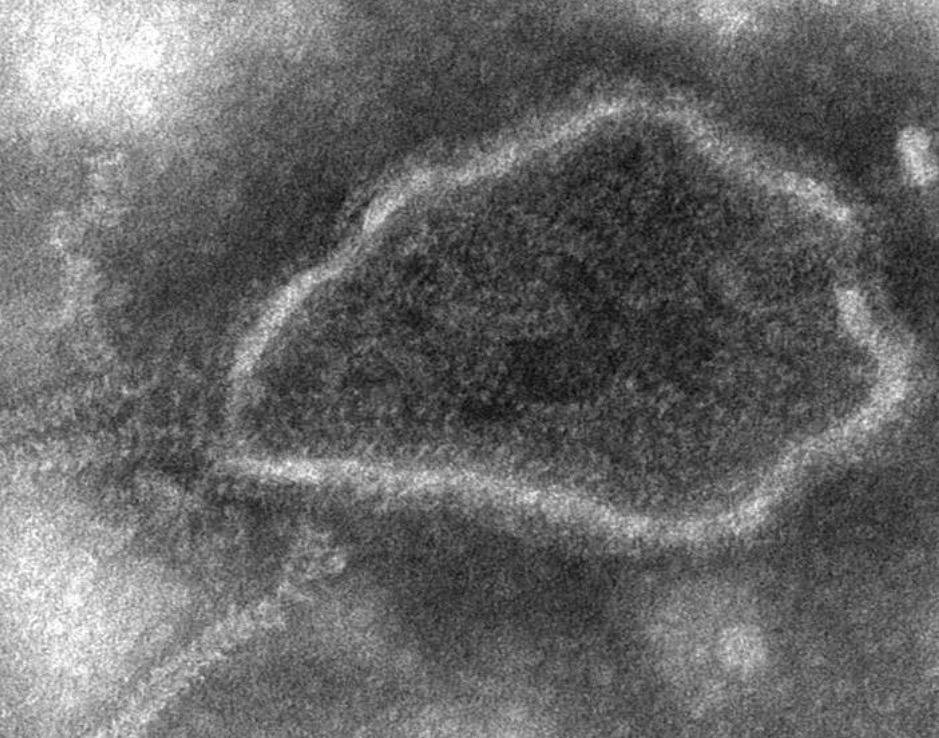 Cryo-Electron Microscopy